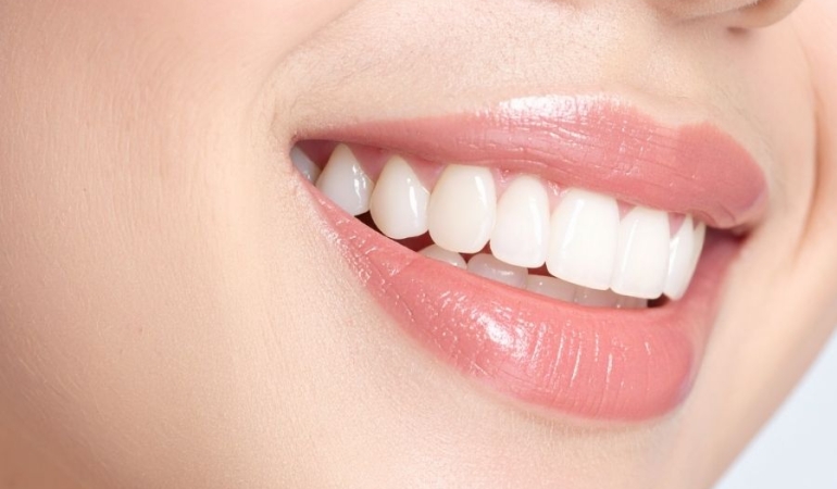 Sağlıklı Gülüşler İçin Modern Diş Çözümleri
